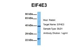 EIF4E3 Rabbit anti-Human, Polyclonal, Novus Biologicals 0.1ml; Unconjugated:Antibodies,